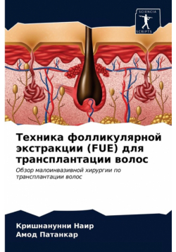 Техника Фолликулярной Экстракции (Fue) Для Трансплантации Волос
