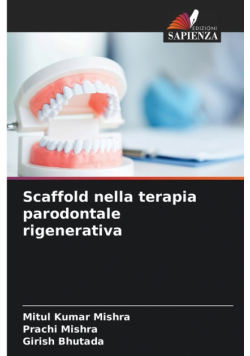 Scaffold nella terapia parodontale rigenerativa