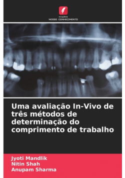 Uma avaliação In-Vivo de três métodos de determinação do comprimento de trabalho