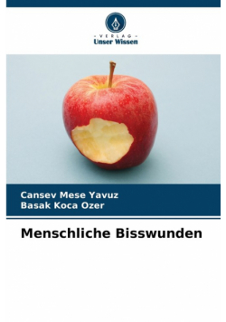 Menschliche Bisswunden