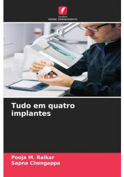 Tudo em quatro implantes