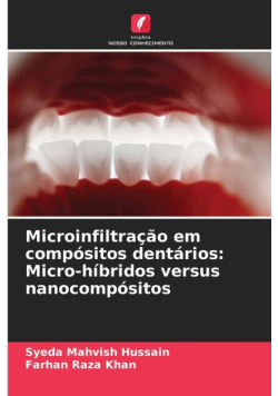 Microinfiltração em compósitos dentários