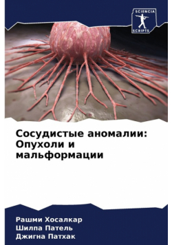Сосудистые аномалии