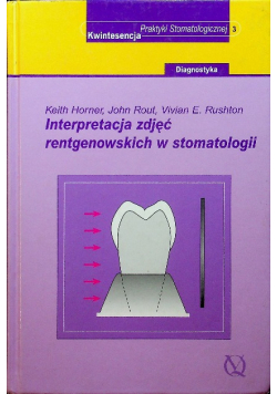 Interpretacja zdjęć rentgenowskich w stomatologii