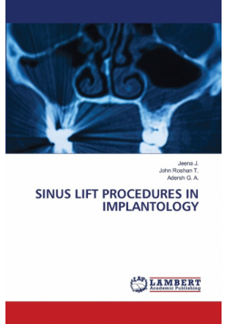 Sinus Lift Procedures In Implantology