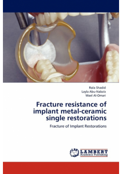 Fracture Resistance of Implant Metal-Ceramic Single Restorations