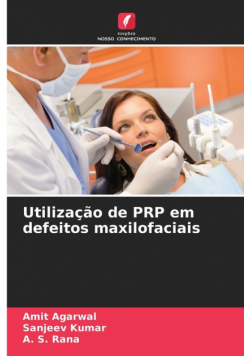 Utilização de PRP em defeitos maxilofaciais