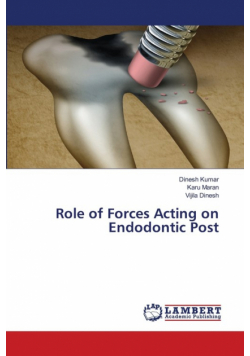 Role of Forces Acting on Endodontic Post
