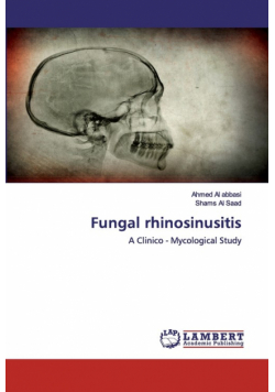 Fungal rhinosinusitis