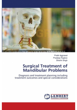 Surgical Treatment of Mandibular Problems