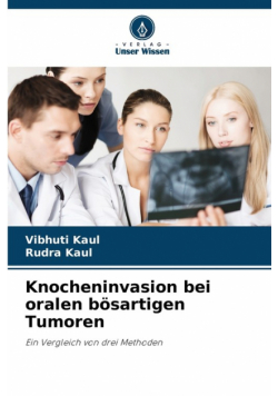 Knocheninvasion bei oralen bösartigen Tumoren