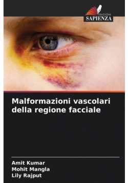 Malformazioni vascolari della regione facciale