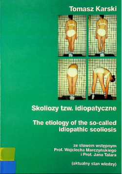 Skoliozy tzw idiopatyczne