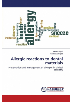 Allergic reactions to dental materials