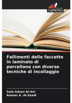 Fallimenti delle faccette in laminato di porcellana con diverse tecniche di incollaggio
