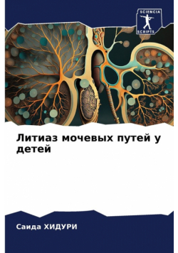 Литиаз мочевых путей у детей