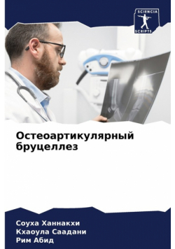 Остеоартикулярный бруцеллез