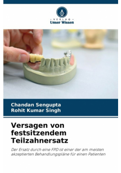 Versagen von festsitzendem Teilzahnersatz