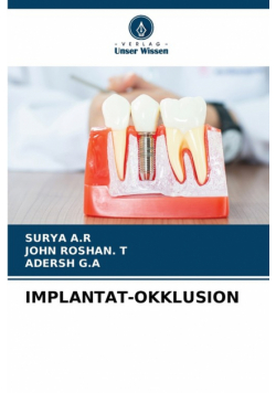Implantat-Okklusion