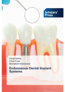 Endosseous Dental Implant Systems