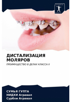 ДИСТАЛИЗАЦИЯ МОЛЯРОВ