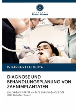 Diagnose Und Behandlungsplanung Von Zahnimplantaten