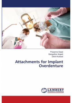 Attachments for Implant Overdenture