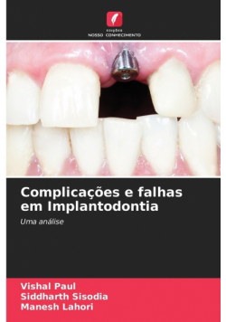Complicações e falhas em Implantodontia