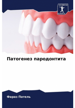 Патогенез пародонтита