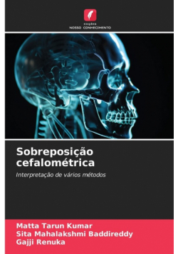 Sobreposição cefalométrica