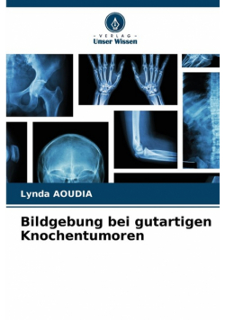 Bildgebung bei gutartigen Knochentumoren