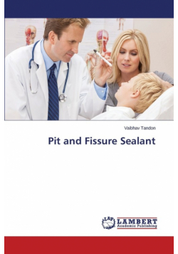 Pit and Fissure Sealant