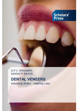 Dental Veneers