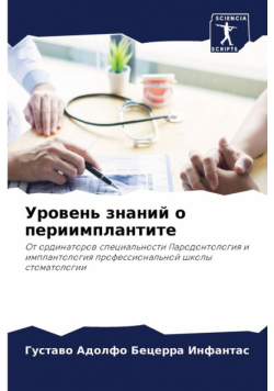 Уровень знаний о периимплантите