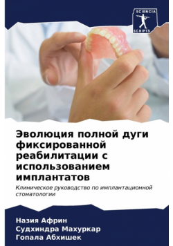 Эволюция полной дуги фиксированной реабилитации с использованием имплантатов