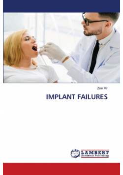 Implant Failures