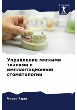 Управление мягкими тканями в имплантационной стоматологии