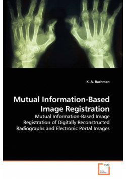 Mutual Information-Based Image Registration