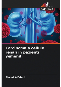 Carcinoma a cellule renali in pazienti yemeniti