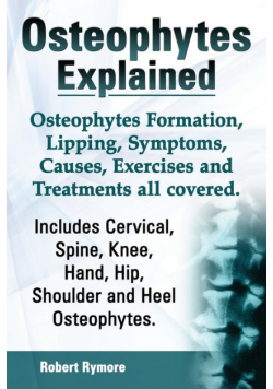 Osteophytes Explained. Osteophytes Formation, Lipping, Symptoms, Causes, Exercises and Treatments All Covered. Includes Cervical, Spine, Knee, Hand, H