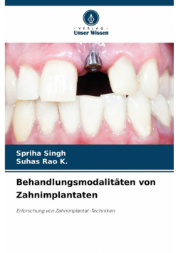 Behandlungsmodalitäten von Zahnimplantaten