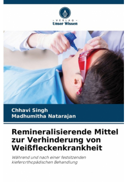 Remineralisierende Mittel zur Verhinderung von Weißfleckenkrankheit