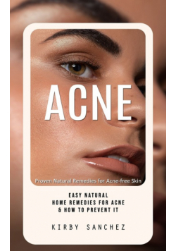 Acne