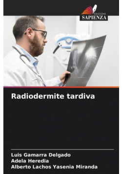 Radiodermite tardiva
