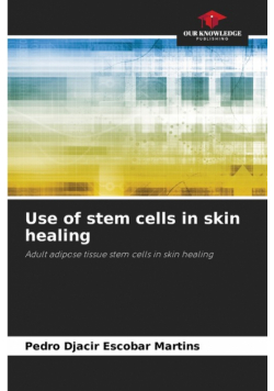 Use of stem cells in skin healing