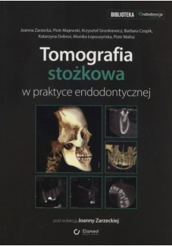 Tomografia stożkowa w praktyce endodontycznej