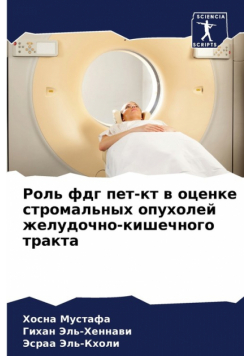 Роль фдг пет-кт в оценке стромальных опухолей желудочно-кишечного тракта