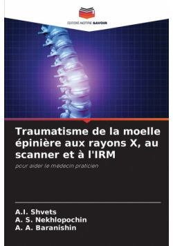 Traumatisme de la moelle épinière aux rayons X, au scanner et à l'IRM