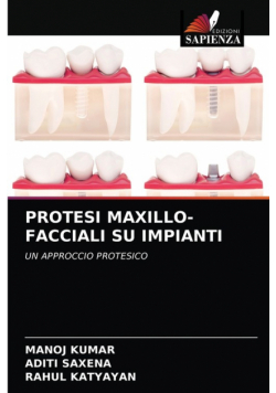 Protesi Maxillo-Facciali Su Impianti