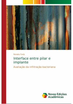 Interface entre pilar e implante